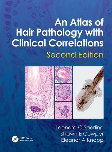 An Atlas of Hair Pathology with Clinical Correlations ebook