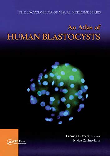 An Atlas of Human Blastocysts ebook