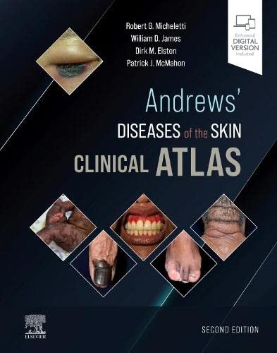 Andrews' Diseases of the Skin Clinical Atlas,, 2nd Edition ebook