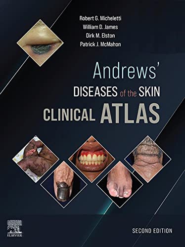 Andrews' Diseases of the Skin Clinical Atlas,, 2nd Edition ebook