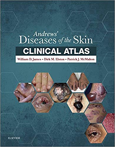 Andrews? Diseases of the Skin Clinical Atlas: Expert Consult Har/Psc Edition ? ebook