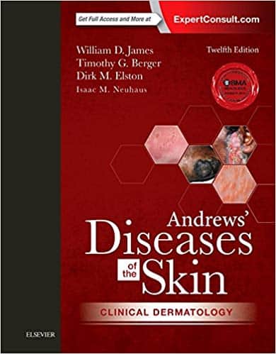 Andrews? Diseases of the Skin: Clinical Dermatology (12th Edition) ? ebook
