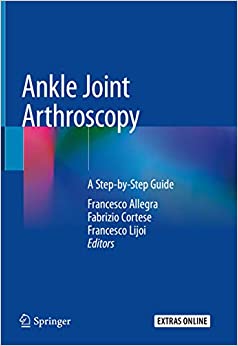 Ankle Joint Arthroscopy: A Step-by-Step Guide ebook