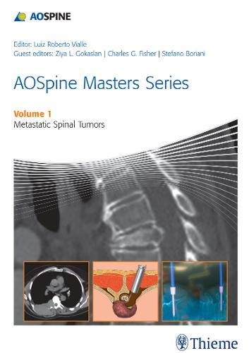 AOSpine Masters Series Volume 1: Metastatic Spinal Tumors ebook