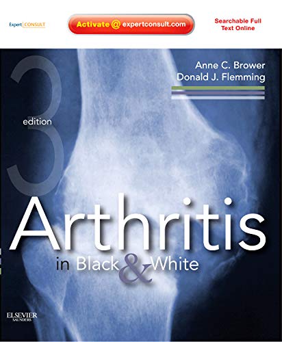 Arthritis in Black and White ebook