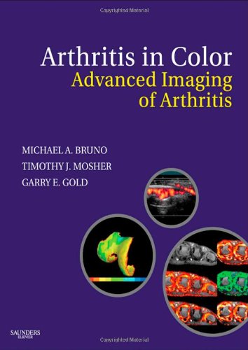 Arthritis in Color ebook