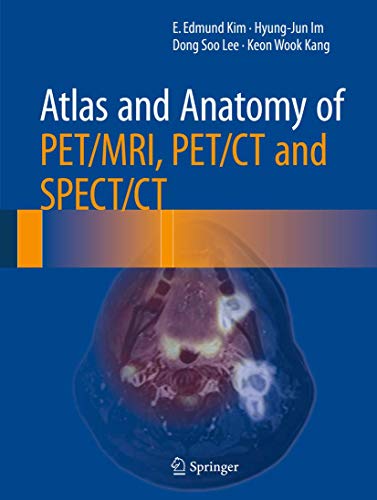 Atlas and Anatomy of PET/MRI, PET/CT and SPECT/CT ebook