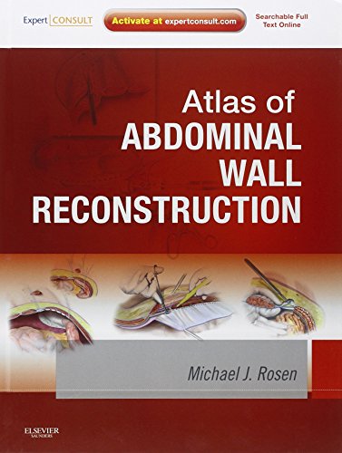 Atlas of Abdominal Wall Reconstruction ebook