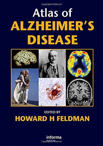 Atlas of Alzheimer?s Disease ebook