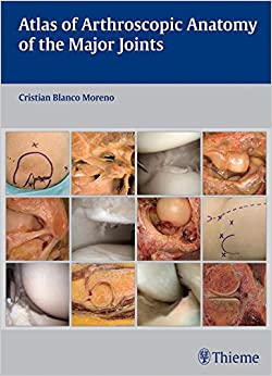 Atlas of Arthroscopic Anatomy of Major Joints ebook