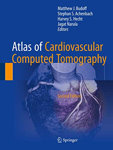 Atlas of Cardiovascular Computed Tomography ebook