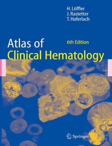 Atlas of Clinical Hematology 6th Edition by Helmut L?ffler ebook