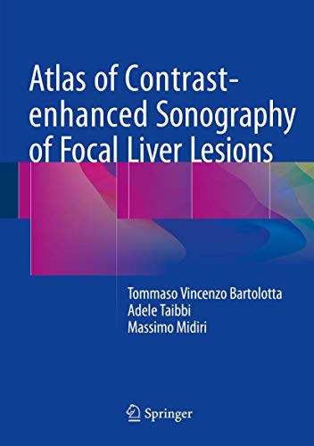 Atlas of Contrast-enhanced Sonography of Focal Liver Lesions ebook
