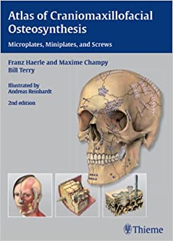 Atlas of Craniomaxillofacial Osteosynthesis: Microplates, Miniplates, and Screws ebook