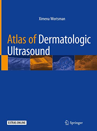 Atlas of Dermatologic Ultrasound ebook