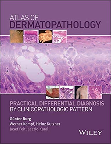 Atlas of Dermatopathology: Practical Differential Diagnosis by Clinicopathologic Pattern ? ebook