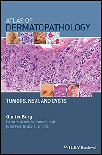 Atlas of Dermatopathology: Tumors, Nevi, and Cysts ? ebook