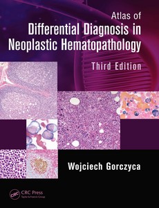 Atlas of Differential Diagnosis in Neoplastic Hematopathology 3rd Edition by Wojciech Gorczyca ebook