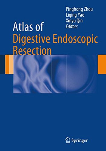 Atlas of Digestive Endoscopic Resection ebook