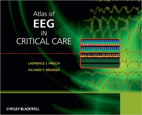 Atlas of EEG in Critical Care ebook