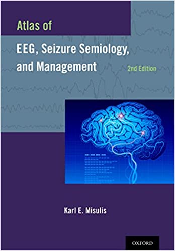 Atlas of EEG, Seizure Semiology, and Management ebook