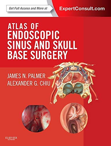 Atlas of Endoscopic Sinus and Skull Base Surgery ebook