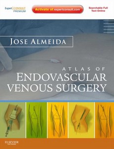 Atlas of Endovascular Venous Surgery by Jose Almeida ebook