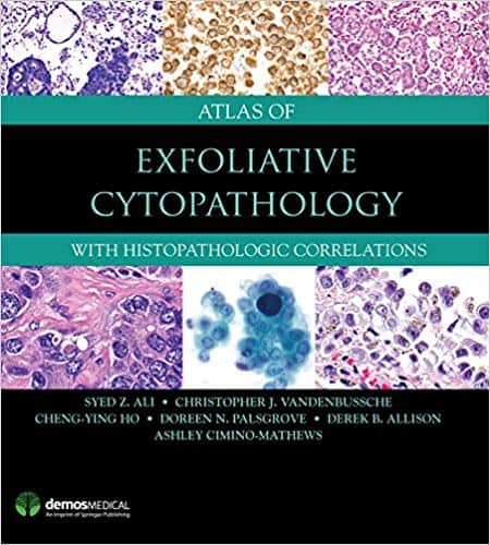 Atlas of Exfoliative Cytopathology: With Histopathologic Correlations ? ebook