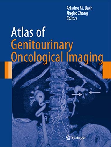Atlas of Genitourinary Oncological Imaging ebook