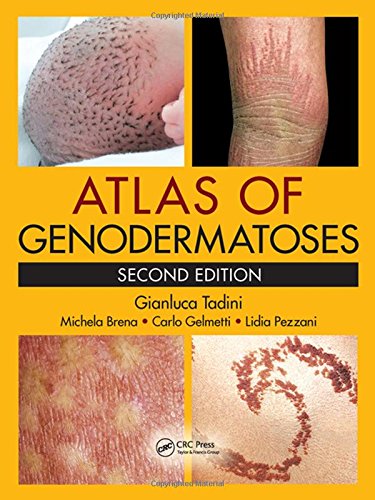 Atlas of Genodermatoses ebook