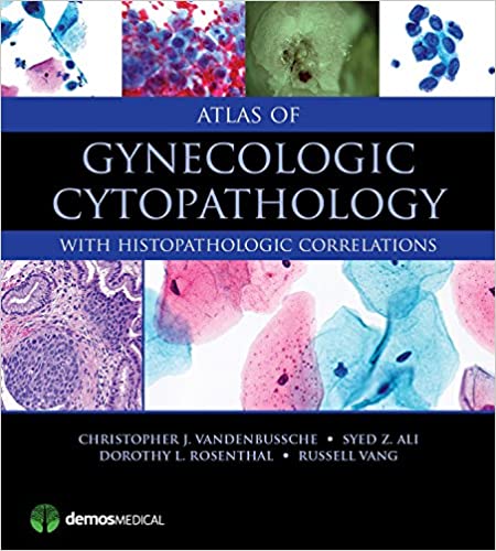 Atlas of Gynecologic Cytopathology: with Histopathologic Correlations ebook