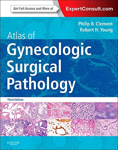 Atlas of Gynecologic Surgical Pathology: Expert Consult: Online ebook