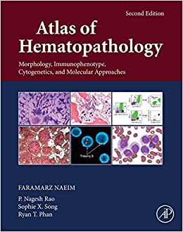 Atlas of Hematopathology: Morphology, Immunophenotype, Cytogenetics, and Molecular Approaches ebook