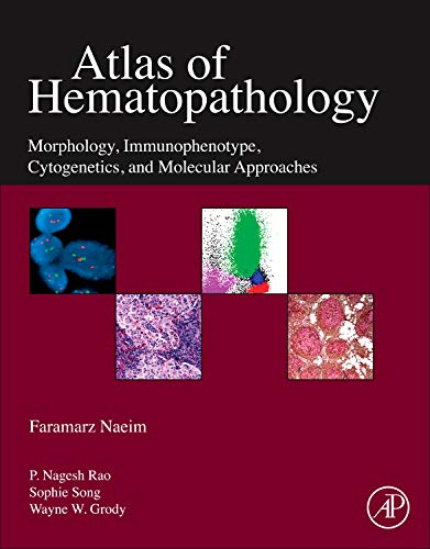 Atlas of Hematopathology: Morphology, Immunophenotype, Cytogenetics, and Molecular Approaches ebook