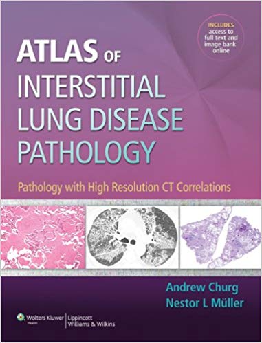 Atlas of Interstitial Lung Disease Pathology: Pathology with High Resolution CT Correlations ? ebook