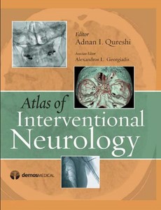 Atlas of Interventional Neurology by Alexandros Georgiadis, MD ebook