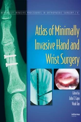 Atlas of Minimally Invasive Hand and Wrist Surgery ebook