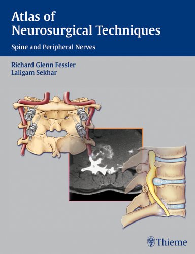 Atlas of Neurosurgical Techniques: Spine and Peripheral Nerves ebook