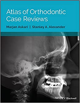 Atlas of Orthodontic Case Reviews ebook