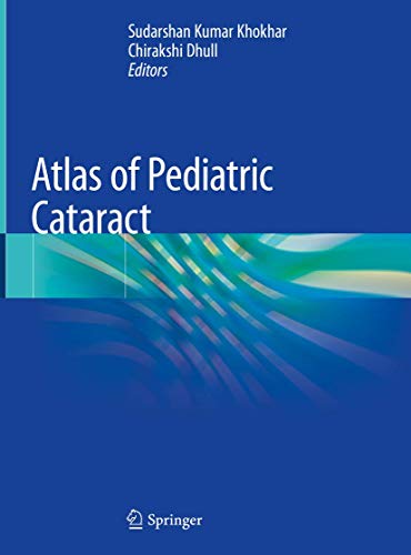 Atlas of Pediatric Cataract ebook