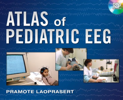 Atlas of Pediatric EEG ebook