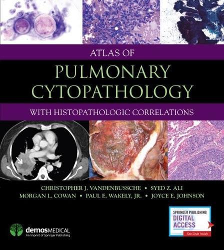 Atlas of Pulmonary Cytopathology ebook