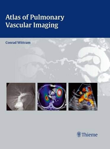 Atlas of Pulmonary Vascular Imaging ebook