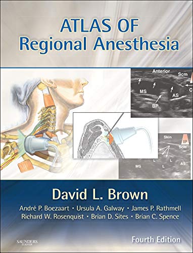 Atlas of Regional Anesthesia ebook