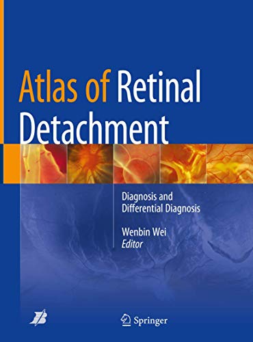 Atlas of Retinal Detachment ebook