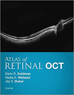Atlas of Retinal OCT: Optical Coherence Tomography ebook