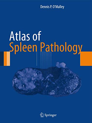 Atlas of Spleen Pathology ebook