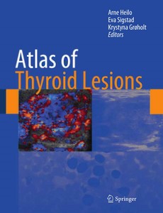 Atlas of Thyroid Lesions by Arne Heilo ebook