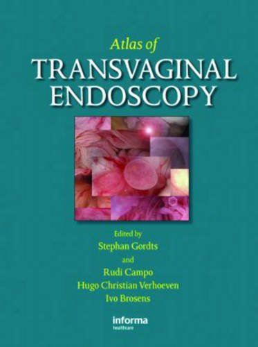 Atlas of Transvaginal Endoscopy ebook