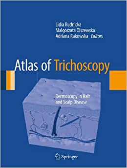 Atlas of Trichoscopy: Dermoscopy in Hair and Scalp Disease ebook